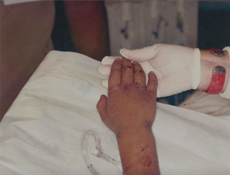  He had cuts and bruises all over his body