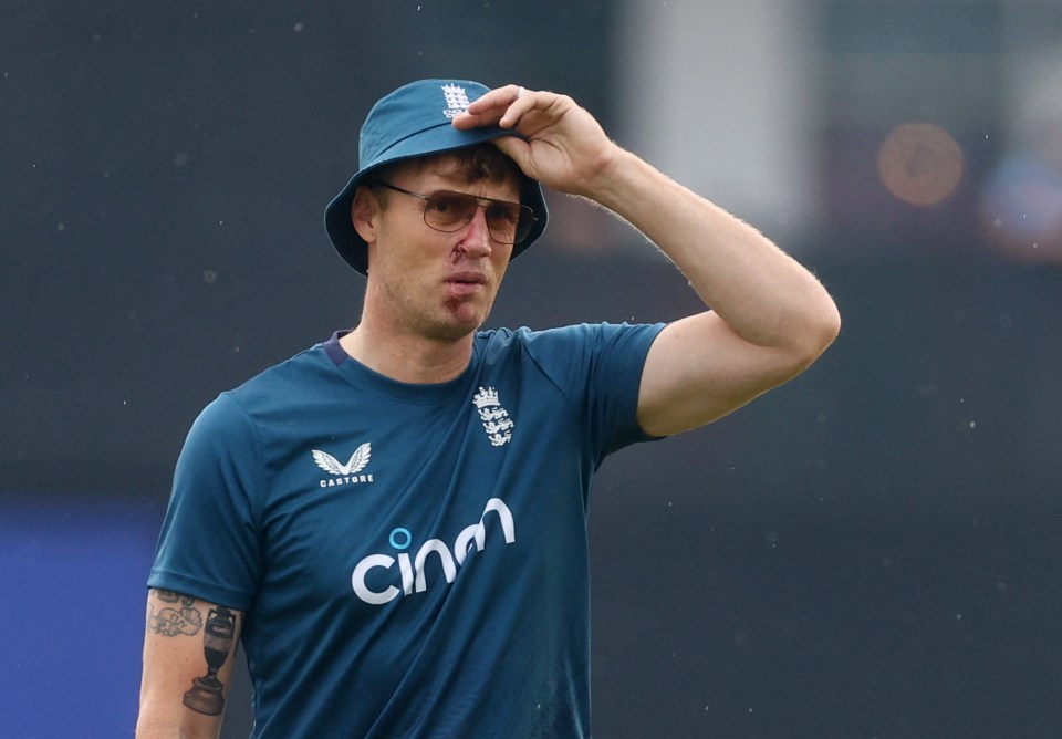 Flintoff suffered facial injuries in a horrific car accident in December