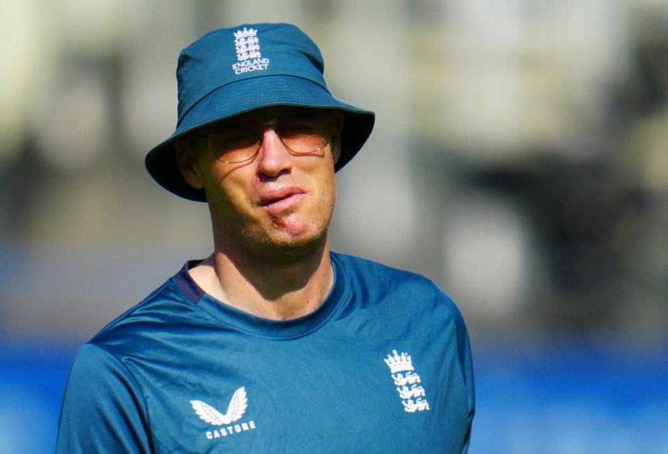 The cricketer's facial injuries are still visible