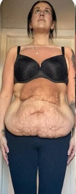 a woman is standing in front of a mirror showing her before and after weight loss .