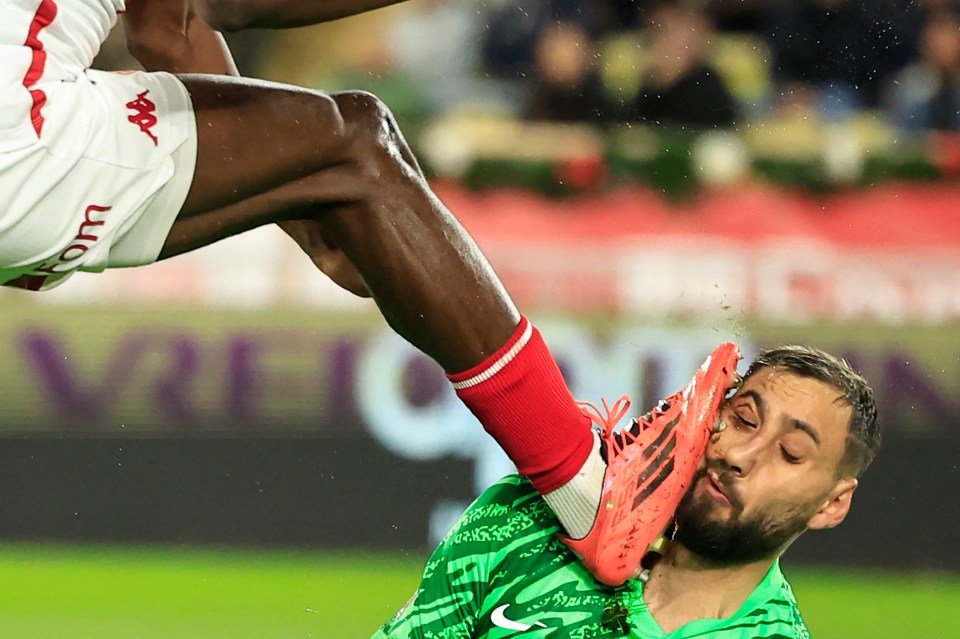 Soccer player Gianluigi Donnarumma is injured by a player's foot to the face.
