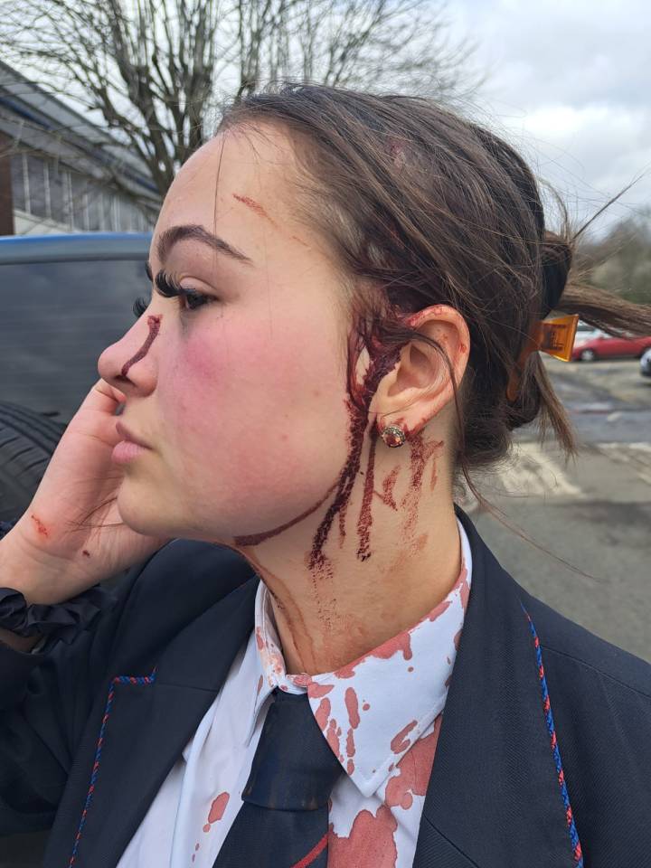 Girl with bloody head wounds after alleged scissor attack.