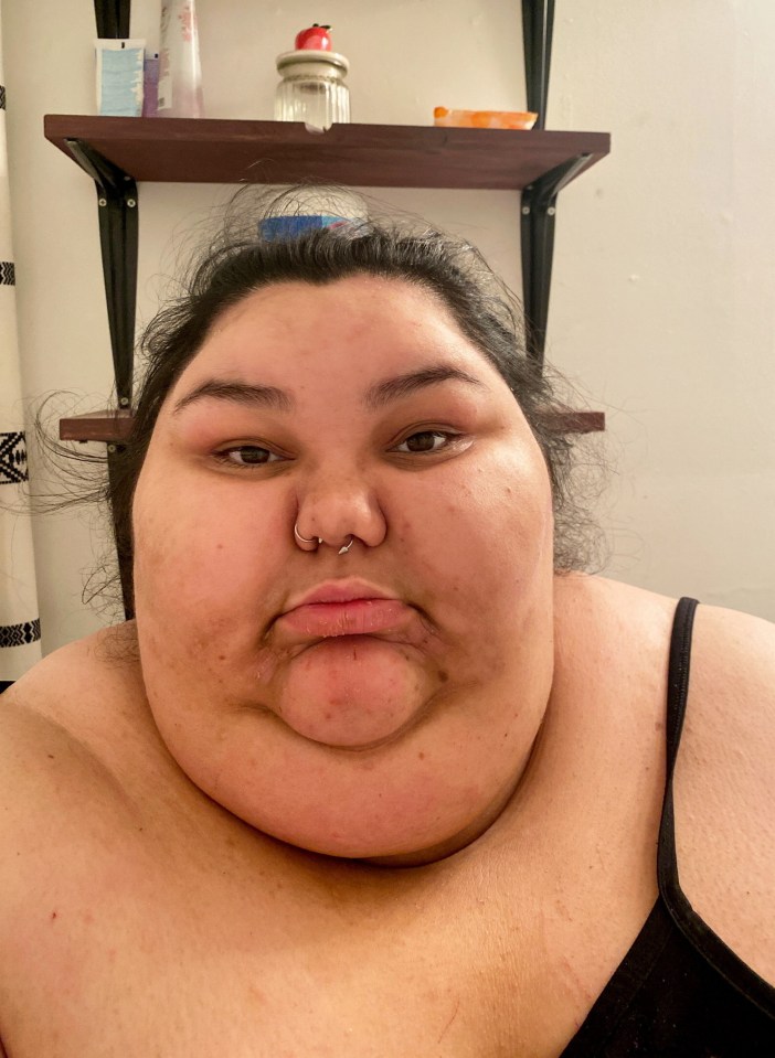 Close-up selfie of a woman before weight loss.