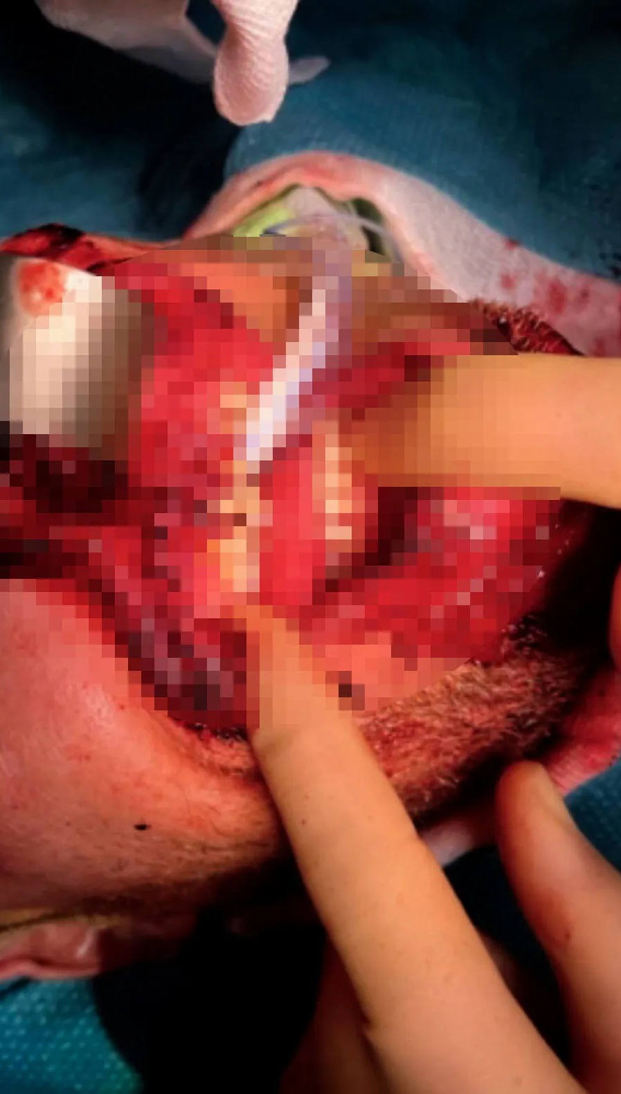 The documentary reveals the full extent of the trauma he endured