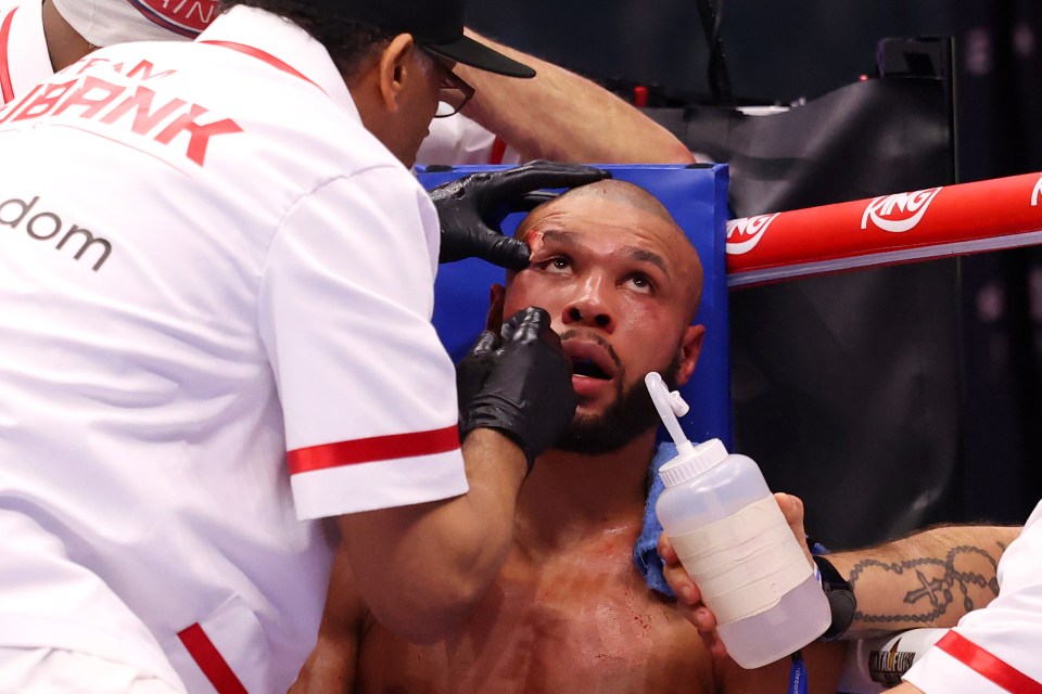 Chris Eubank Jr. having a cut above his eye treated by his team between rounds of a boxing match.