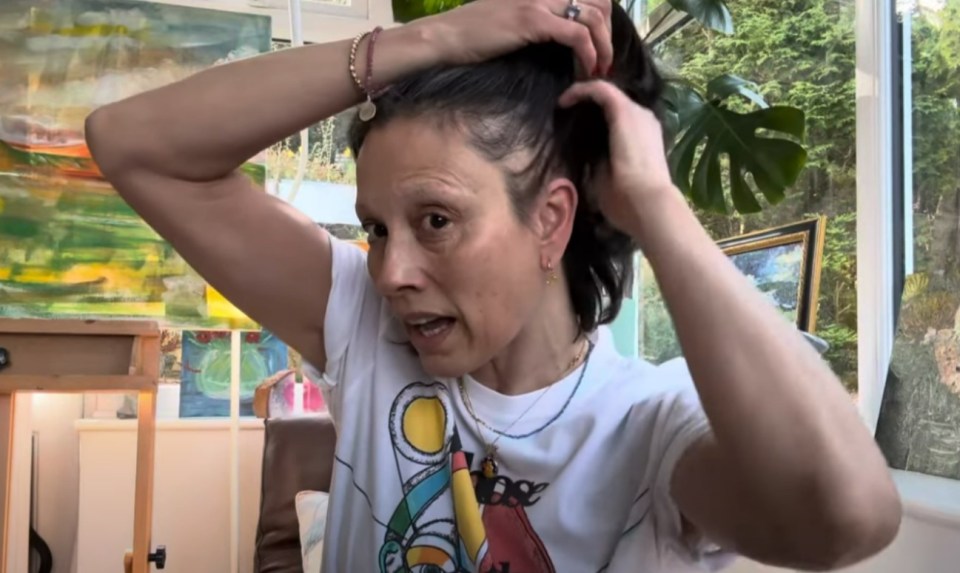 Woman pulling her hair up, revealing hair loss.