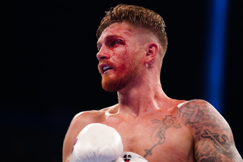 Archie Sharp in action against Ryan Garner (not pictured) at The O2, London. Picture date: Saturday July 27, 2024. PA Photo. See PA story BOXING London. Photo credit should read: Zac Goodwin/PA Wire. RESTRICTIONS: Use subject to restrictions. Editorial use only, no commercial use without prior consent from rights holder.