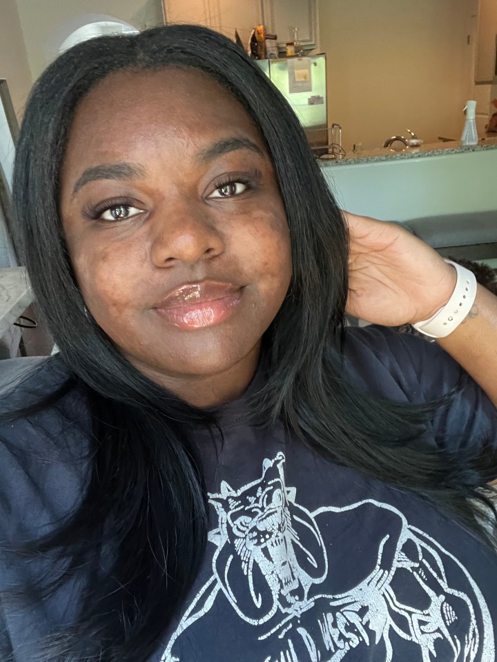 Close-up selfie of a woman showing her weight loss after using Ozempic.